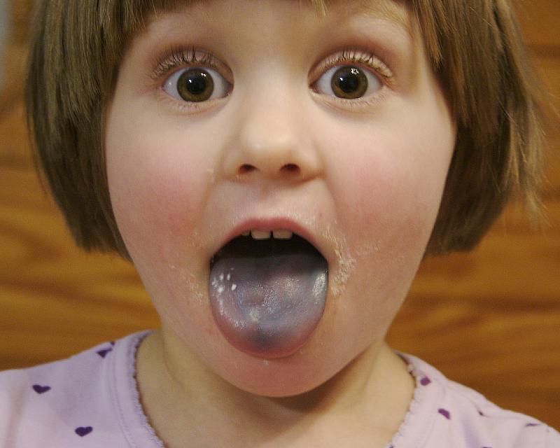 Blue Tongue